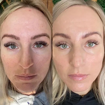 FACIALISTA RADIANT C SERUM + CREAM