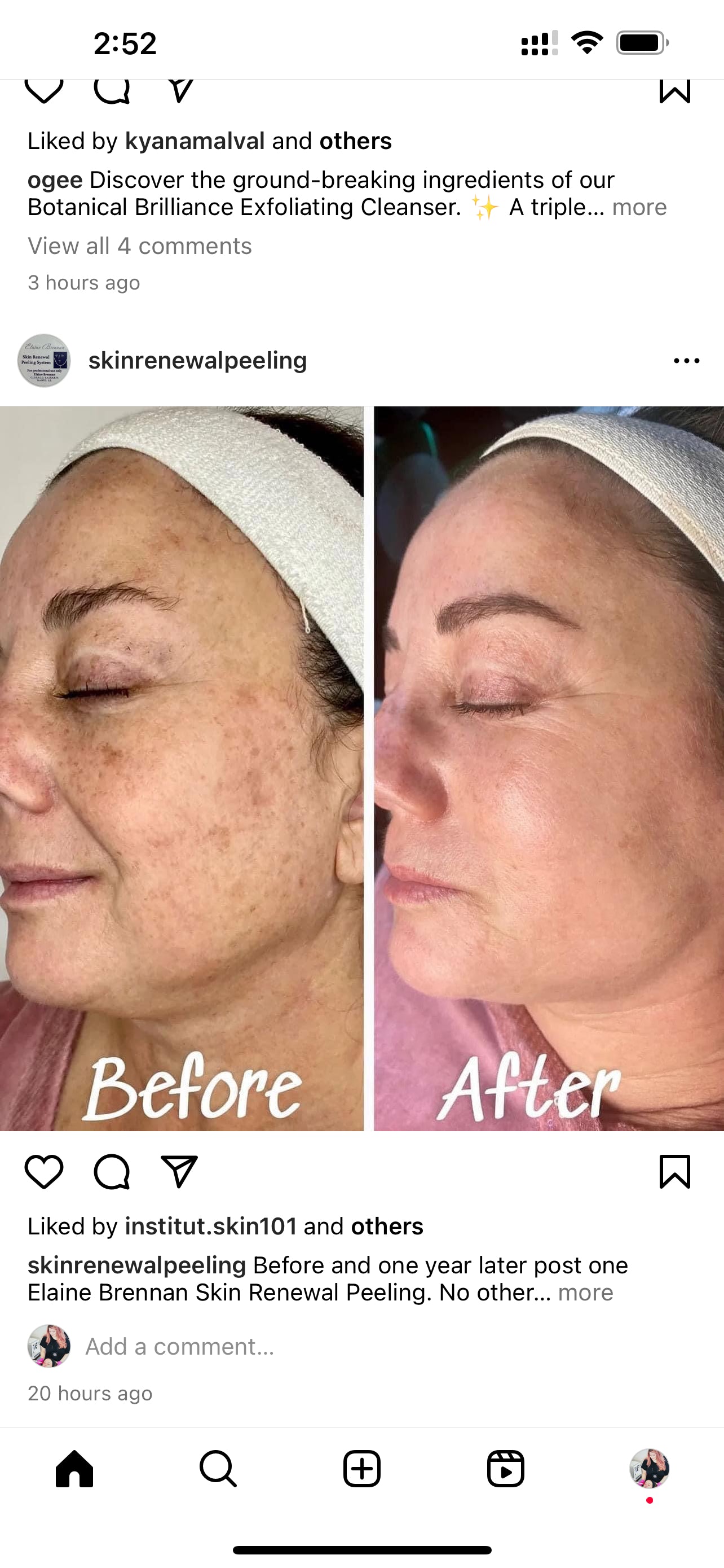 Clear Skin Collective Pigment Perfect Tone Correcting Serum