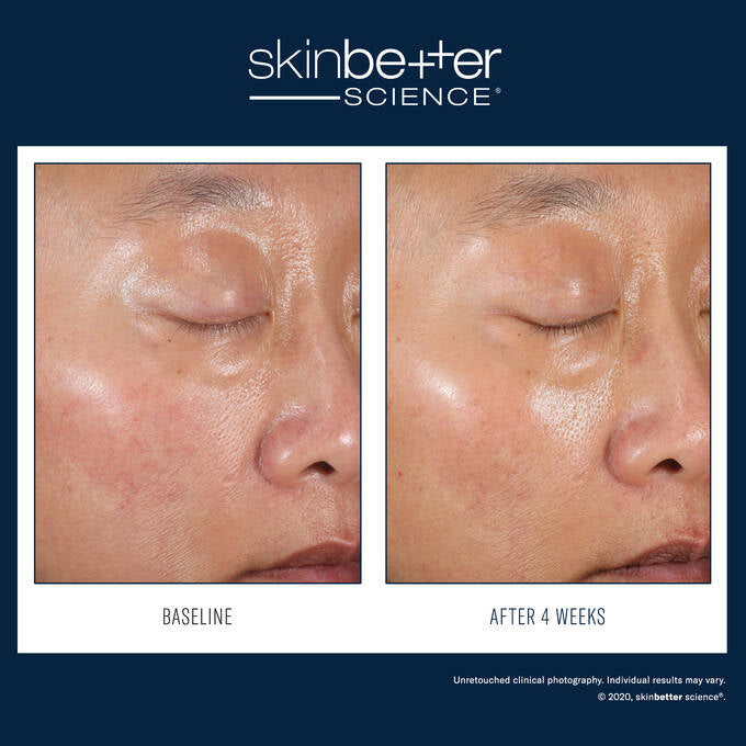 Skin Better A-TEAM DUO KIT ADVANCED