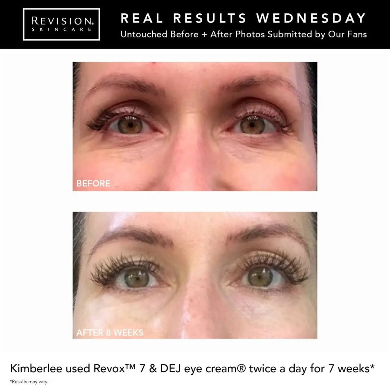 Revision Eye + Face DEJ Cream Duo