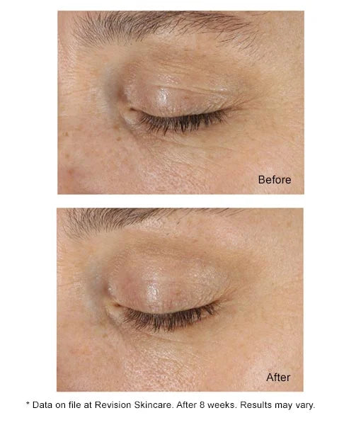 Revision Eye + Face DEJ Cream Duo