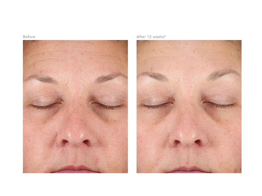 Revision Eye + Face DEJ Cream Duo