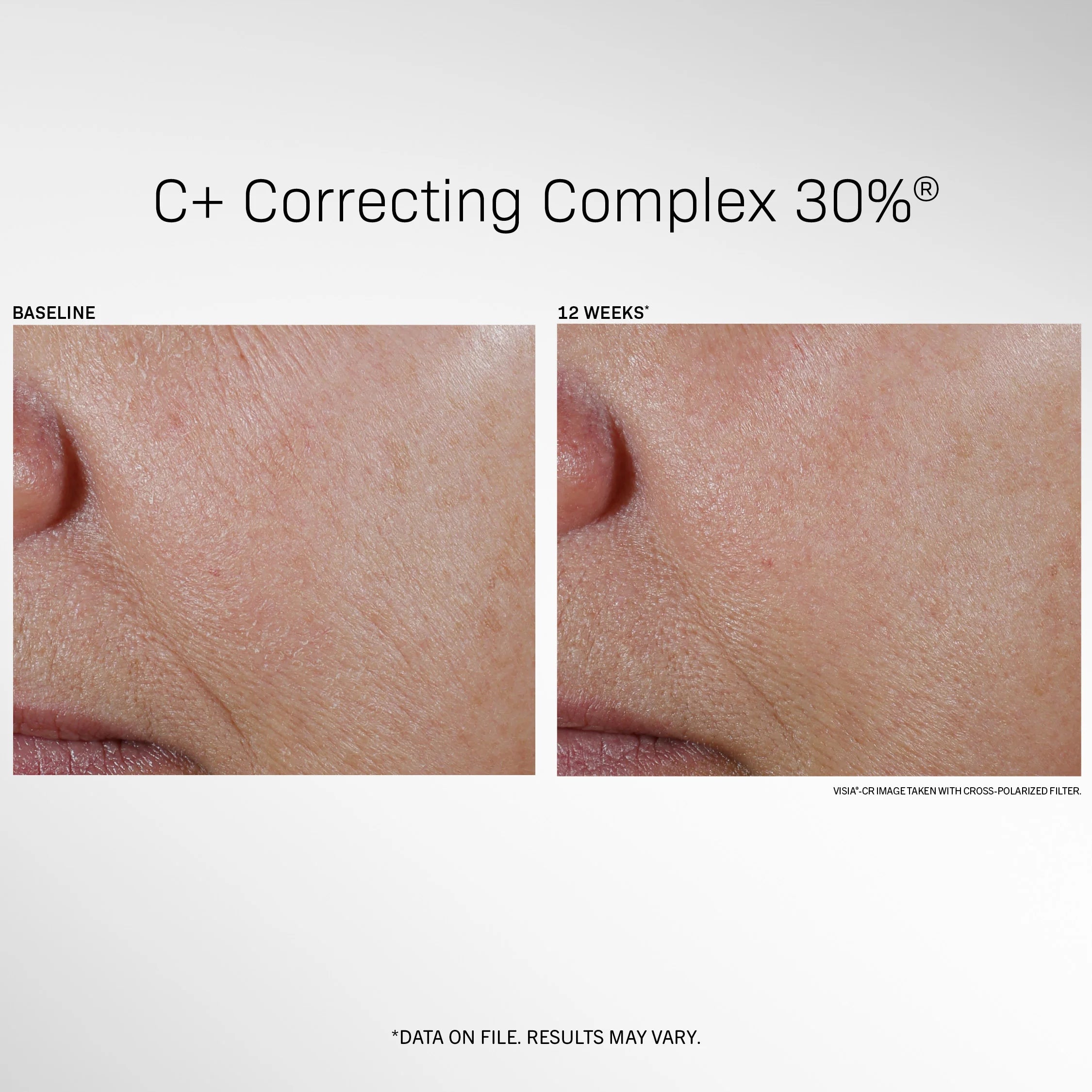 Revision C+ Correcting Complex 30%® 1 FL OZ