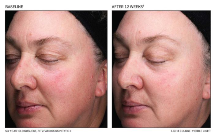 Revision Skincare D·E·J Daily Boosting Serum