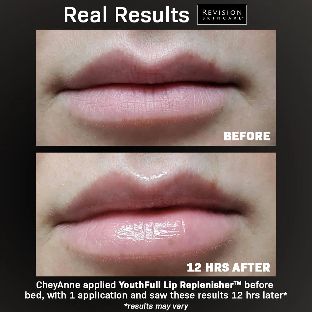 REVISION YouthFull Lip Replenisher® 0.33 oz