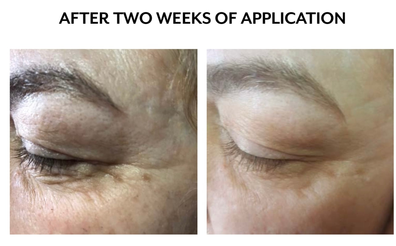 DNA SKIN INSTITUTE CRYOSTEM SIGNAL PLUS