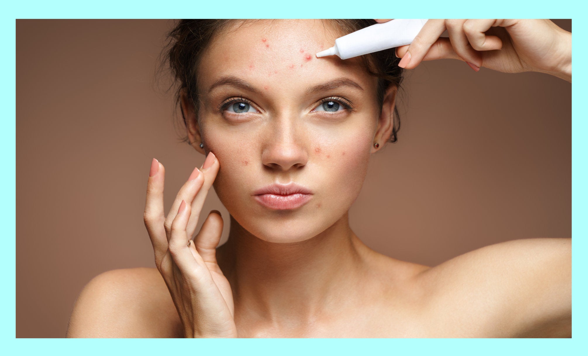 Face Reality: Our Favourite Acne-Fighting Skincare Products