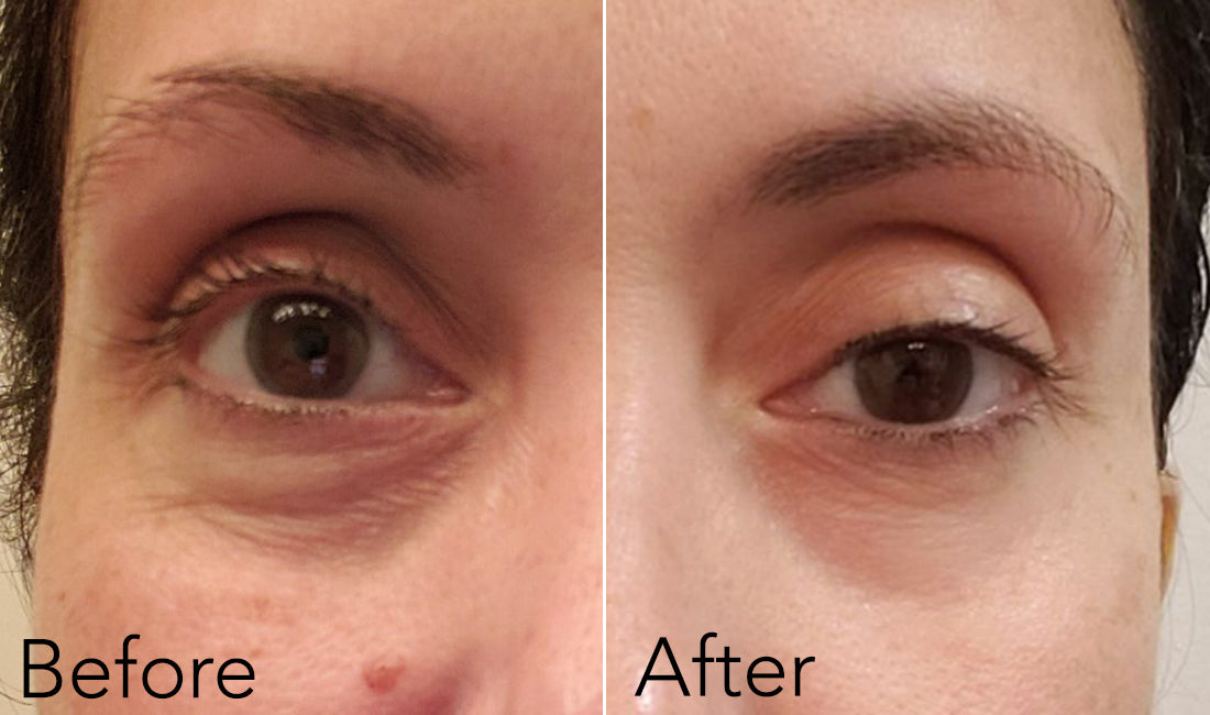 Airbrush Eye Renewal