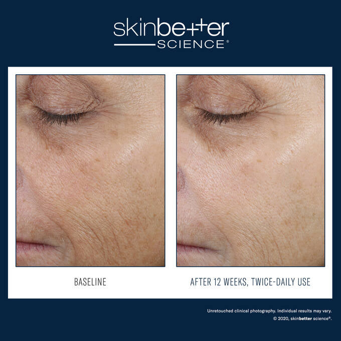 SKIN BETTER - Even Tone Correcting Serum™ Face 50 ML