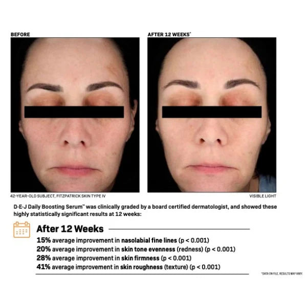 Revision Skincare D·E·J Daily Boosting Serum