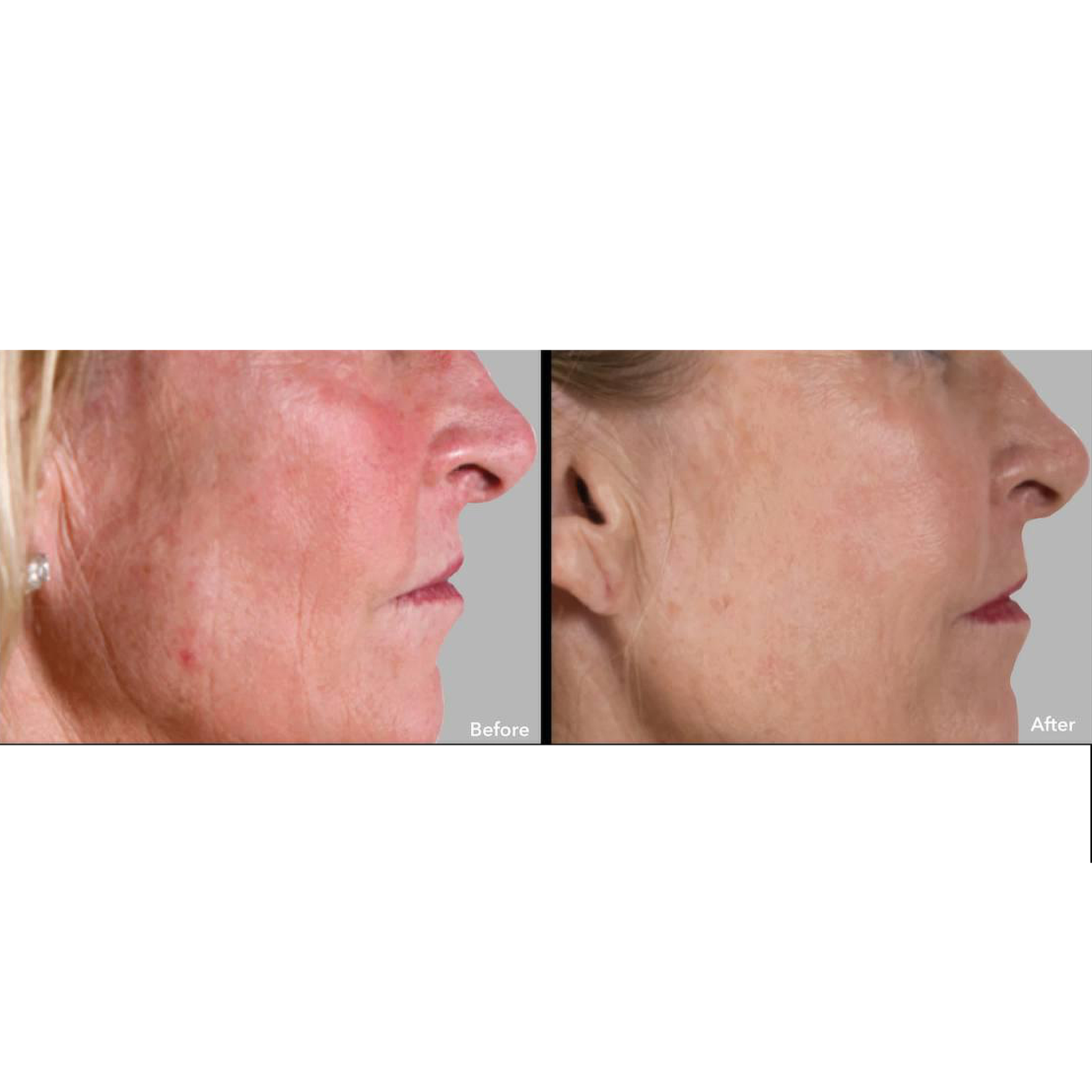 AnteAGE MD SERUM + ACCELERATOR - Beauty Nook