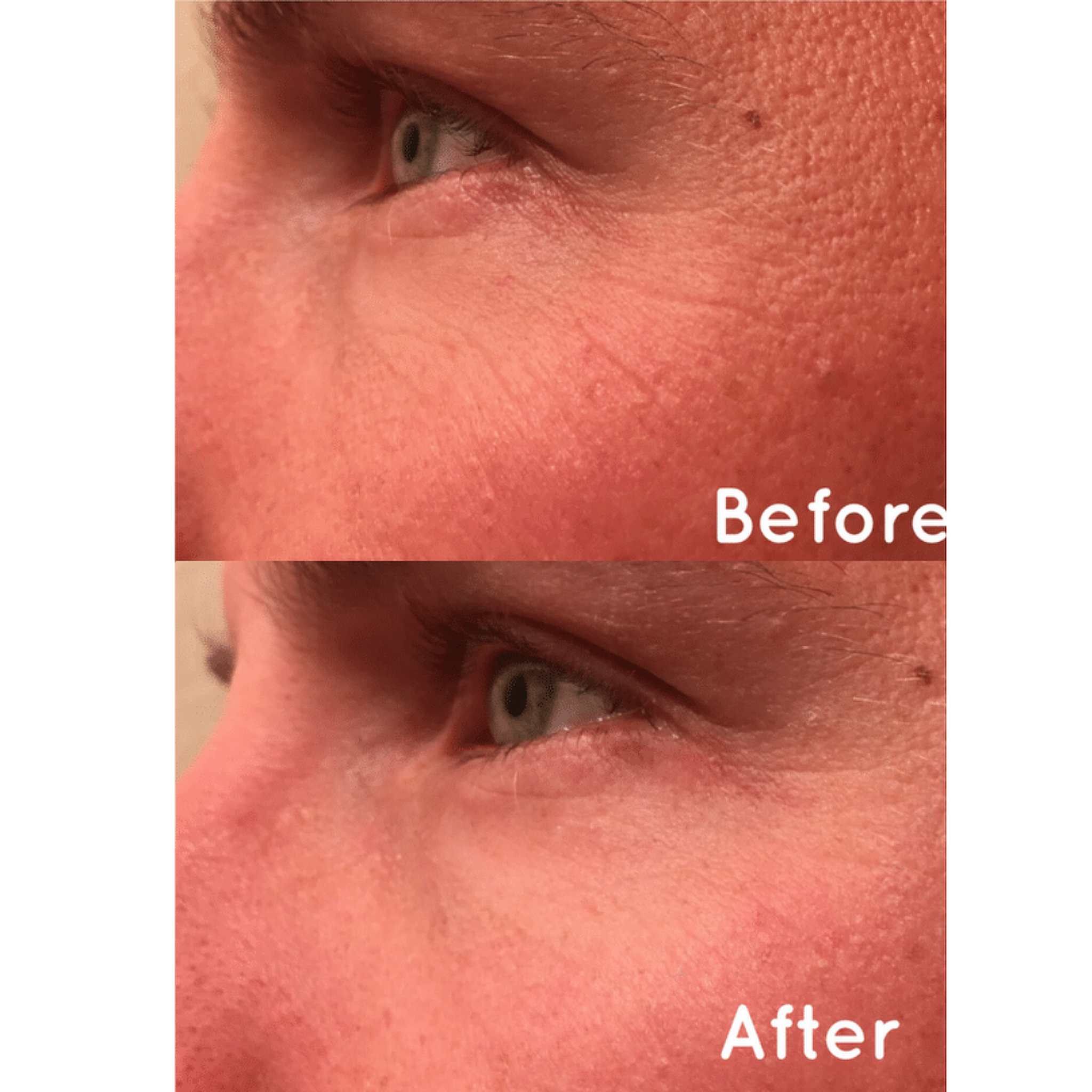 Eye Rejuvenator + Microcurrent - Beauty Nook